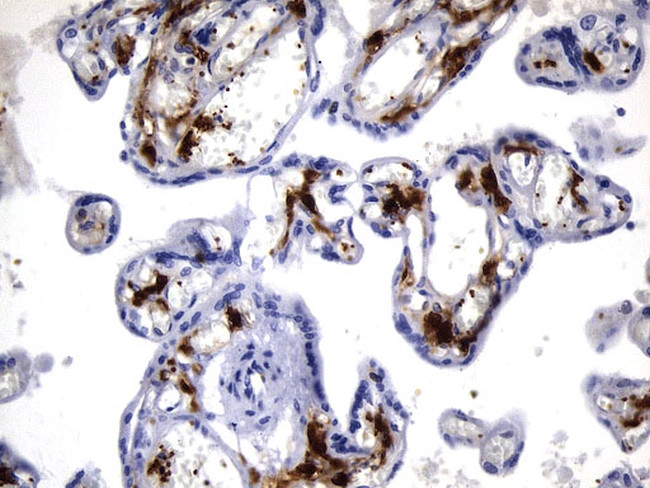 F13A1 Antibody in Immunohistochemistry (Paraffin) (IHC (P))