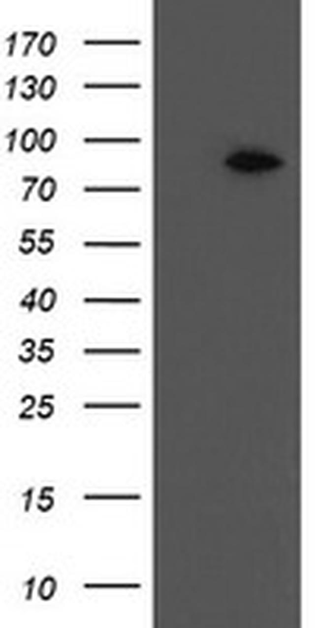 F13A1 Antibody in Western Blot (WB)