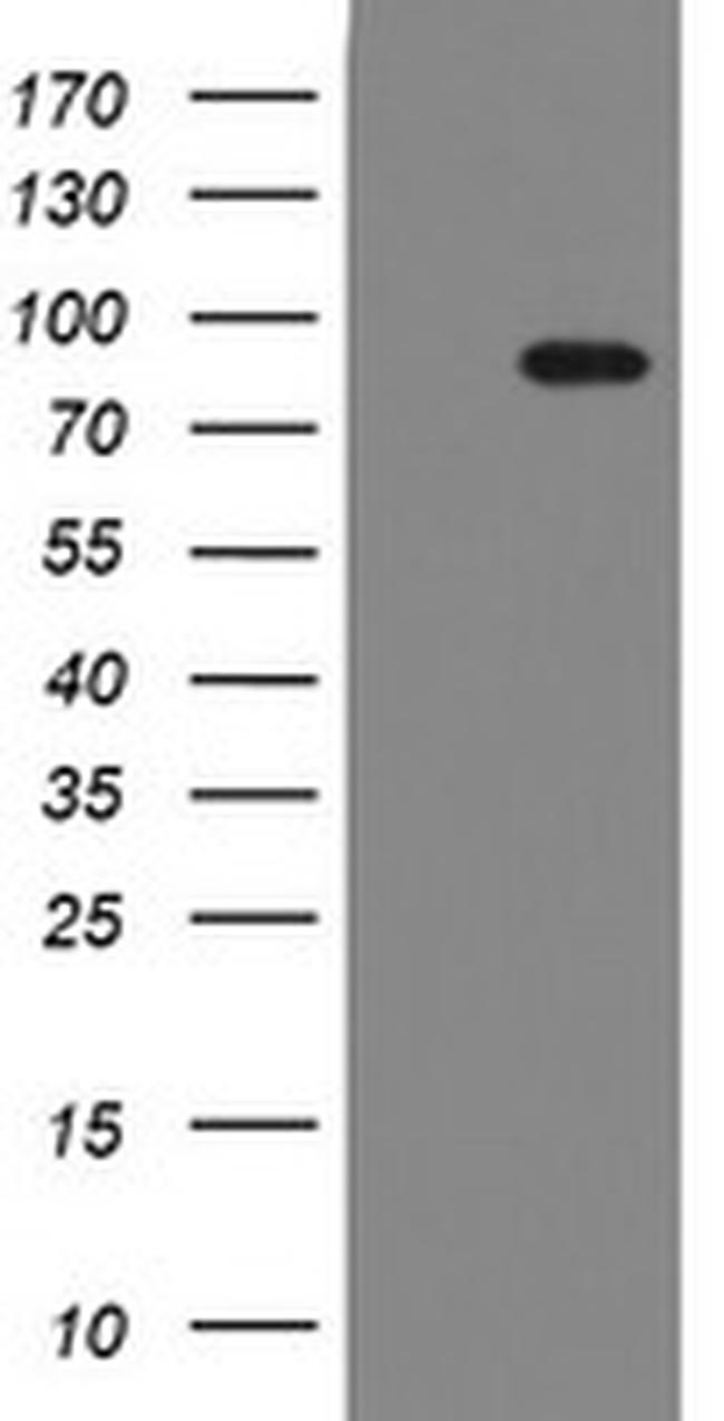 F13A1 Antibody in Western Blot (WB)