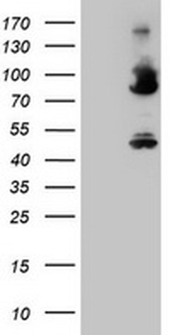 F13A1 Antibody in Western Blot (WB)