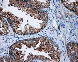 FAHD2A Antibody in Immunohistochemistry (Paraffin) (IHC (P))