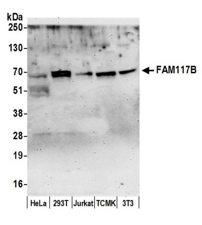 FAM117B/ALS2CR13 Antibody in Western Blot (WB)