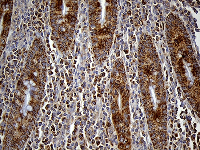 FAM54A Antibody in Immunohistochemistry (Paraffin) (IHC (P))