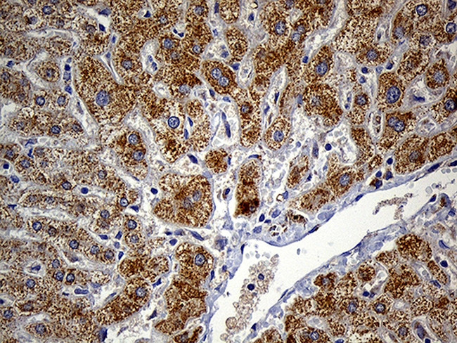 FAM54A Antibody in Immunohistochemistry (Paraffin) (IHC (P))