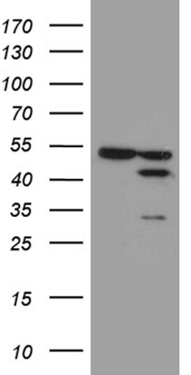 FAM54A Antibody in Western Blot (WB)