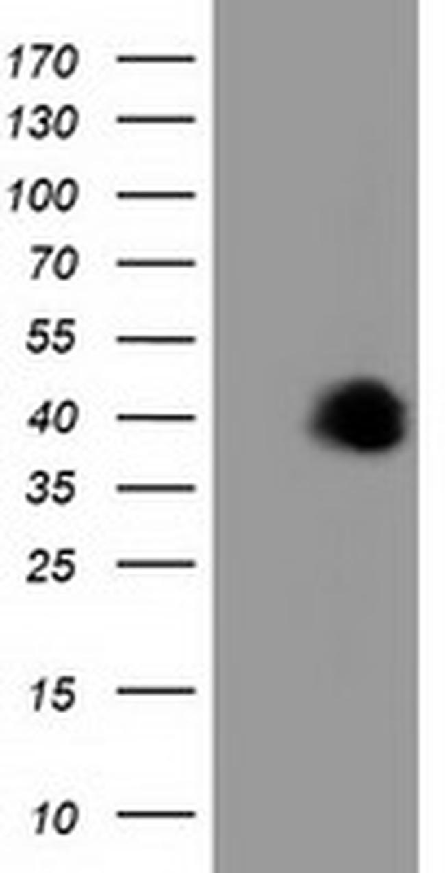 FAM84B Antibody in Western Blot (WB)