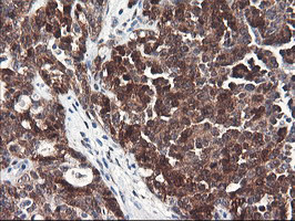 FBXO21 Antibody in Immunohistochemistry (Paraffin) (IHC (P))