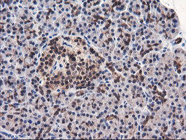 FBXO21 Antibody in Immunohistochemistry (Paraffin) (IHC (P))