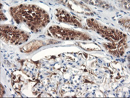 FBXO21 Antibody in Immunohistochemistry (Paraffin) (IHC (P))