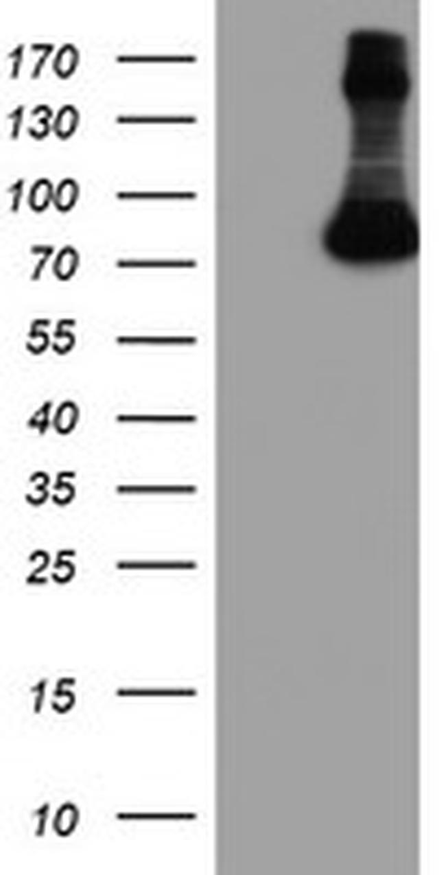 FBXO21 Antibody in Western Blot (WB)