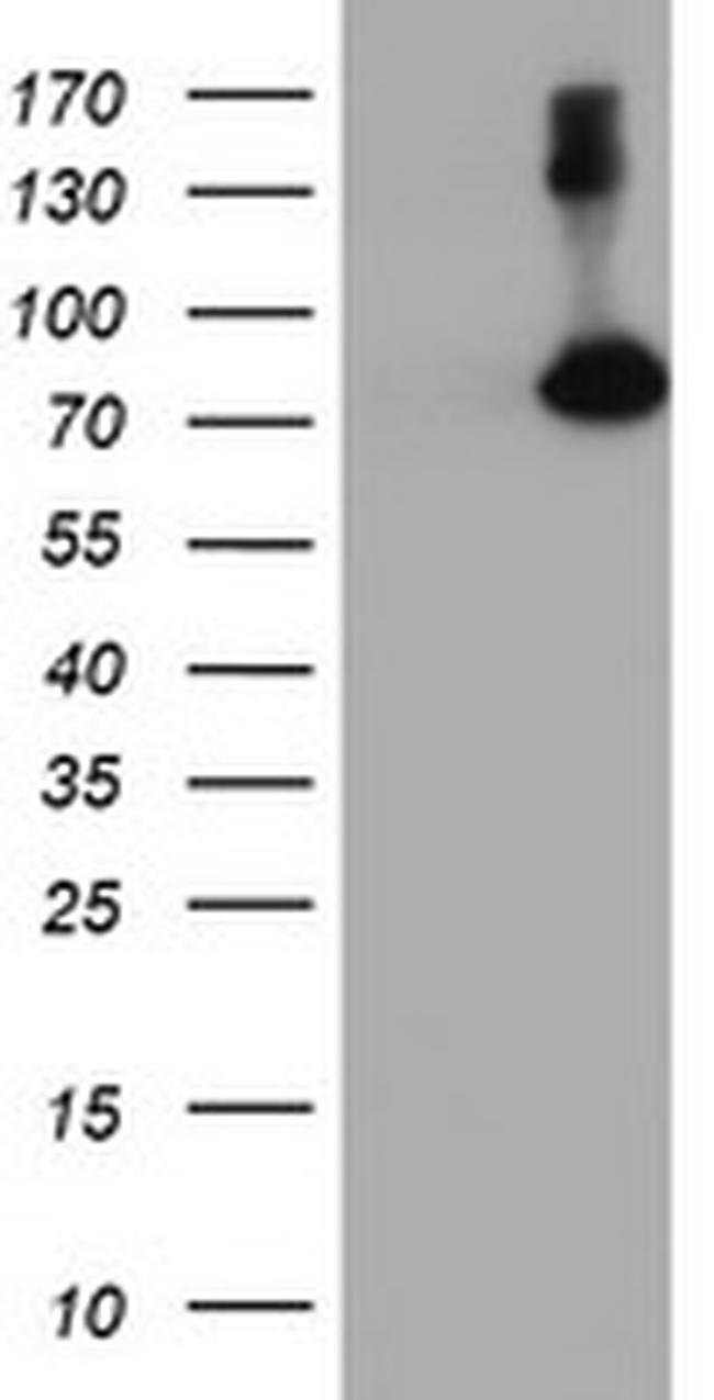 FBXO21 Antibody in Western Blot (WB)