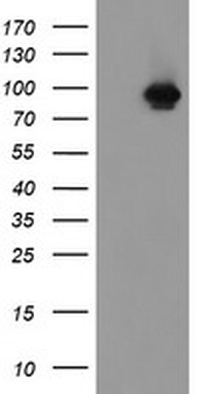 FBXO42 Antibody in Western Blot (WB)