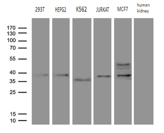 FBXO6 Antibody in Western Blot (WB)