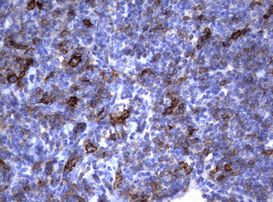 FCER2 Antibody in Immunohistochemistry (Paraffin) (IHC (P))