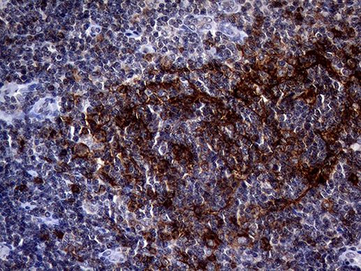 FCER2 Antibody in Immunohistochemistry (Paraffin) (IHC (P))