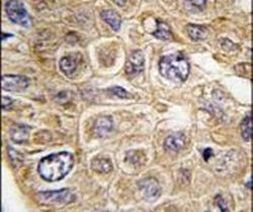 FDFT1 Antibody in Immunohistochemistry (IHC)