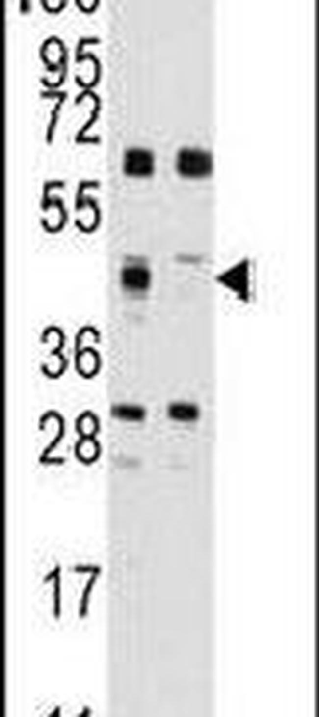 FDFT1 Antibody in Western Blot (WB)