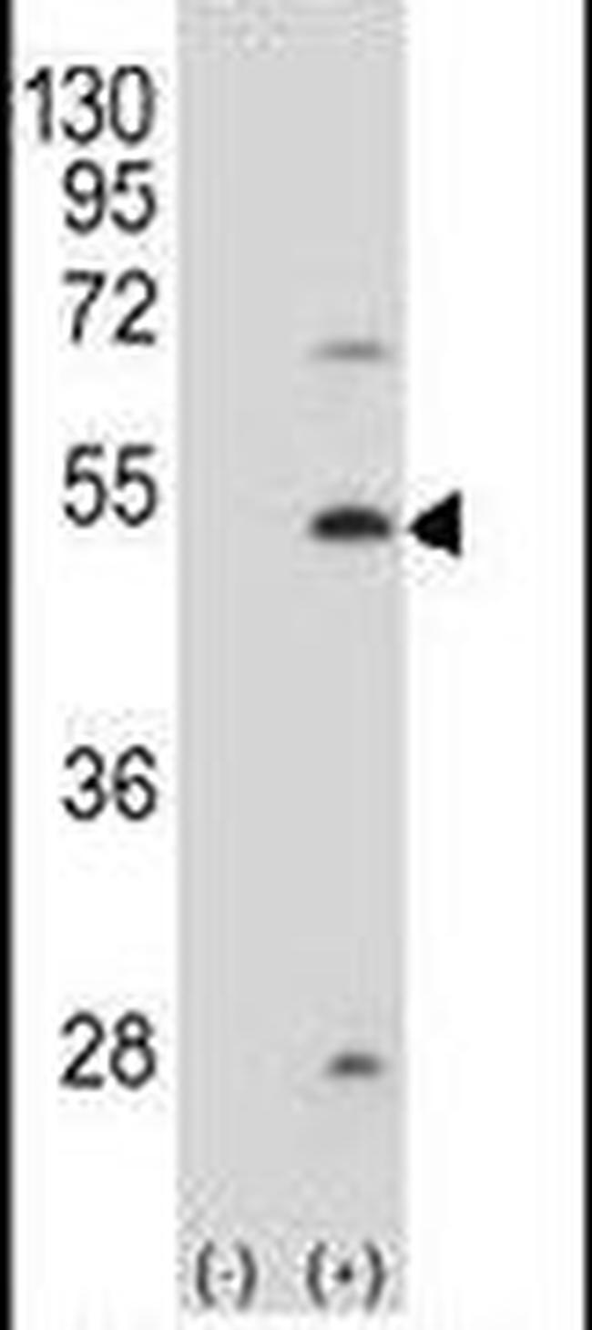 FDFT1 Antibody in Western Blot (WB)