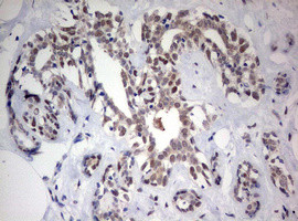 FEN1 Antibody in Immunohistochemistry (Paraffin) (IHC (P))
