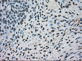 FERMT2 Antibody in Immunohistochemistry (Paraffin) (IHC (P))