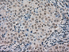 FERMT2 Antibody in Immunohistochemistry (Paraffin) (IHC (P))