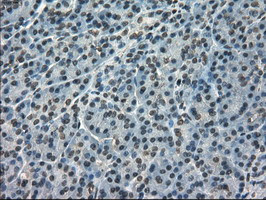 FERMT2 Antibody in Immunohistochemistry (Paraffin) (IHC (P))