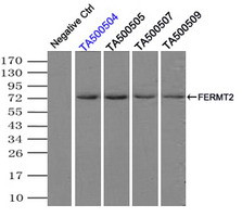 FERMT2 Antibody in Immunoprecipitation (IP)