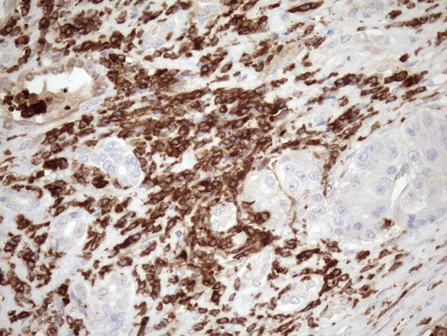 FERMT3 Antibody in Immunohistochemistry (Paraffin) (IHC (P))