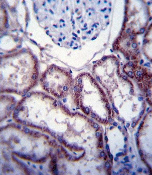 FER Antibody in Immunohistochemistry (IHC)