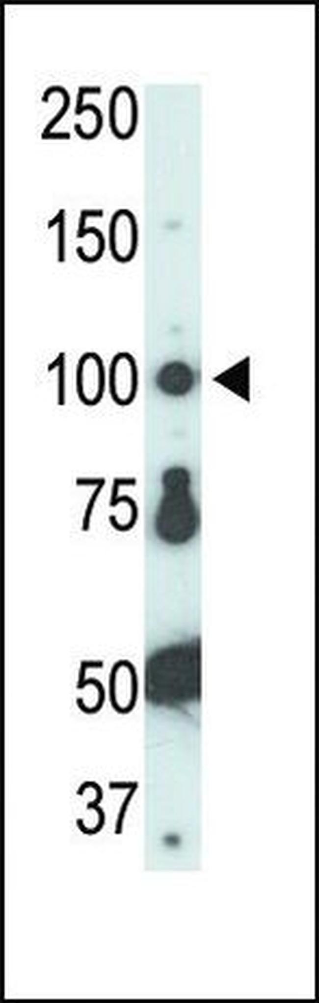 FER Antibody in Western Blot (WB)