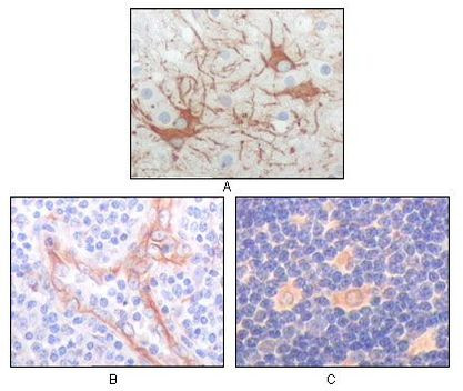 FES Antibody in Immunohistochemistry (Paraffin) (IHC (P))