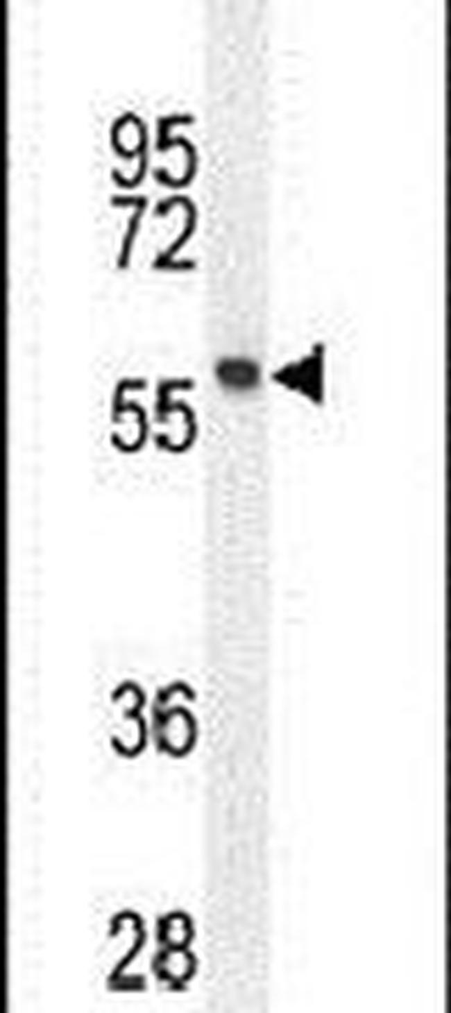 FEZF1 Antibody in Western Blot (WB)