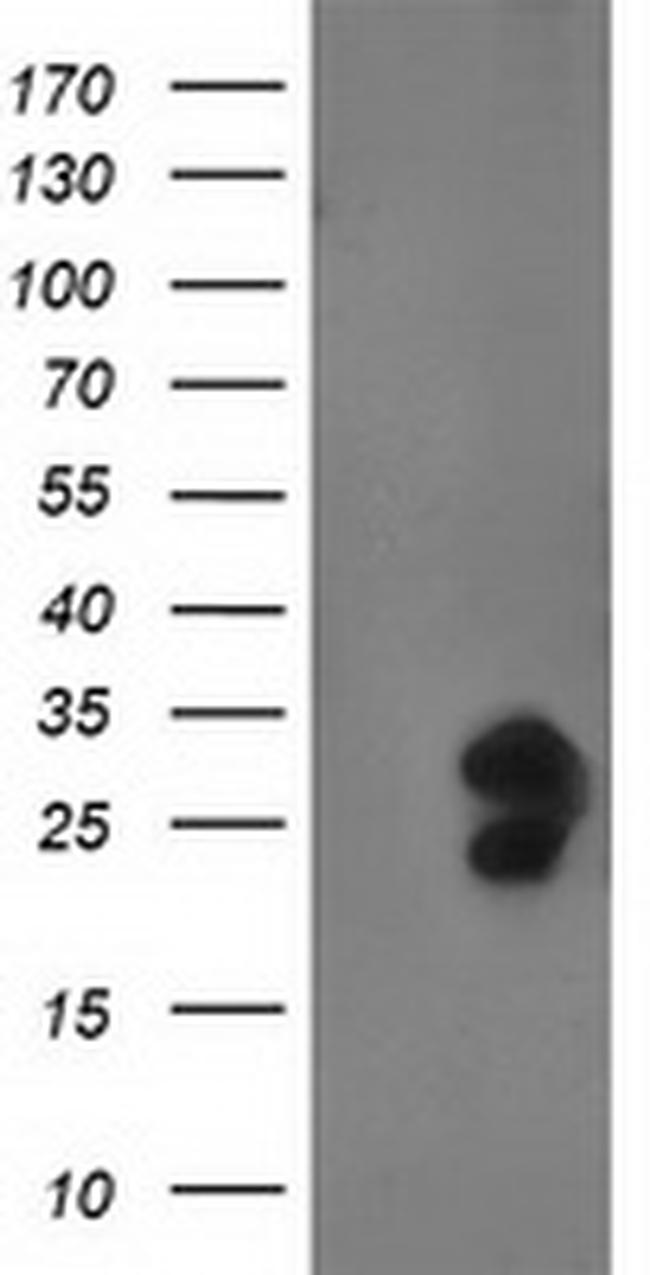 FGF21 Antibody in Western Blot (WB)