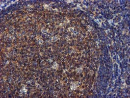 FGFR2 Antibody in Immunohistochemistry (Paraffin) (IHC (P))