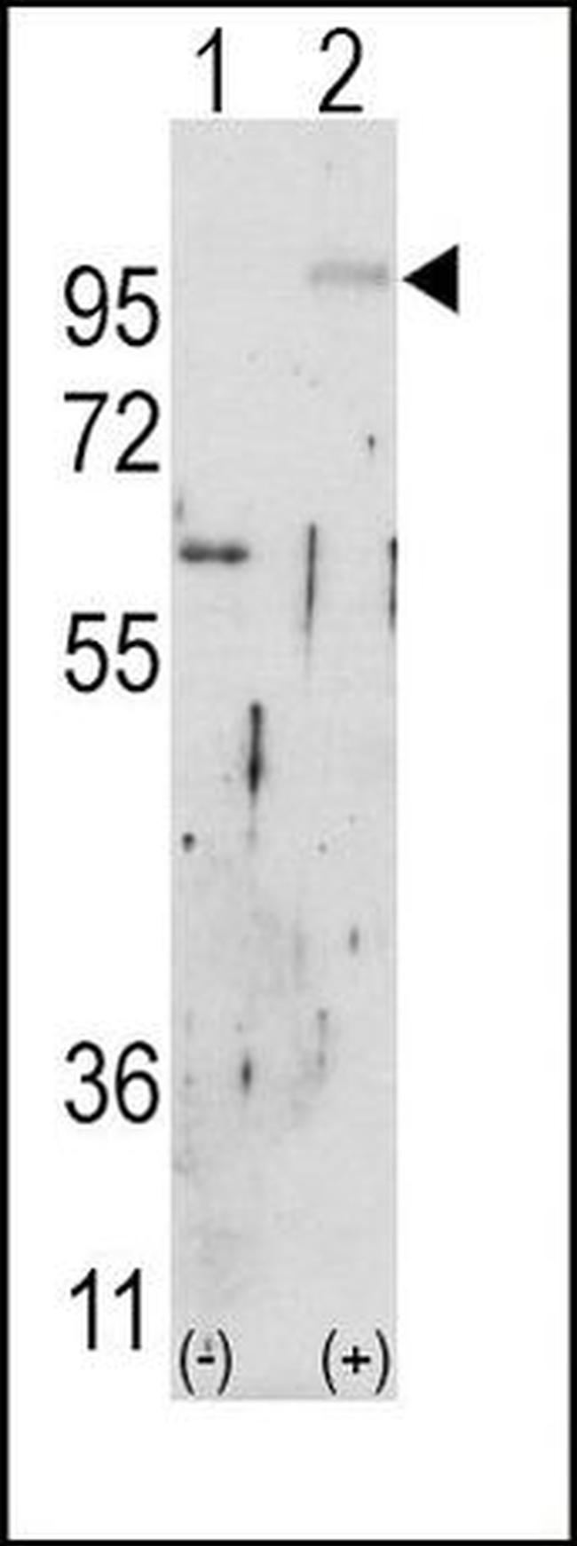 FGFR2 Antibody in Western Blot (WB)