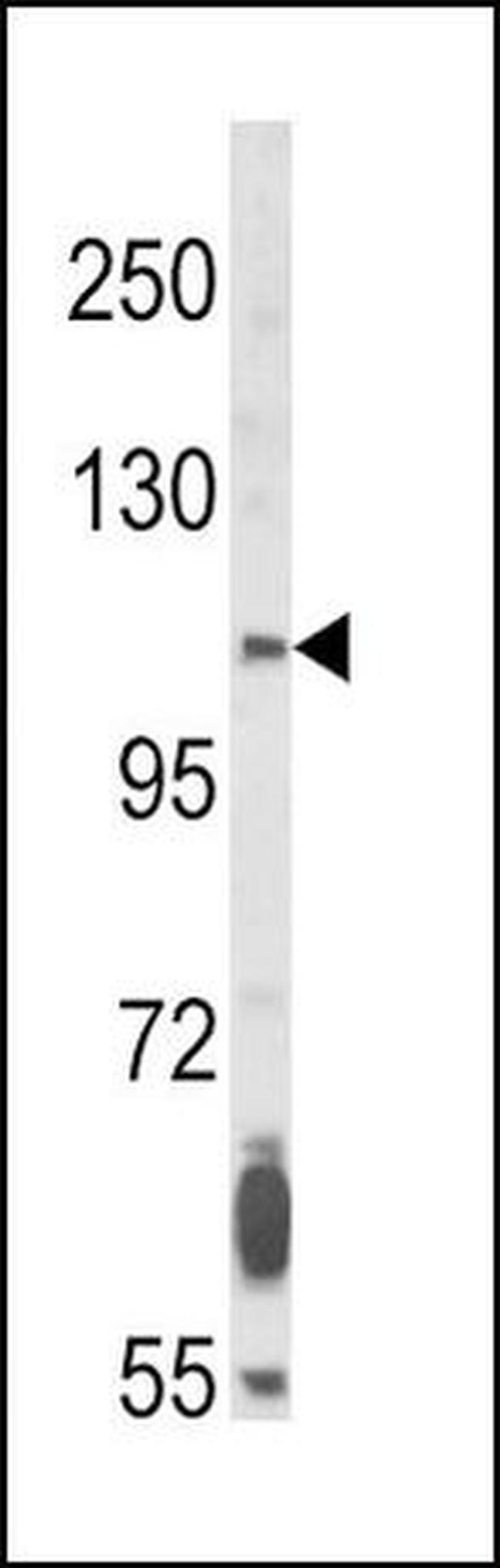 FGFR2 Antibody in Western Blot (WB)