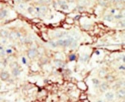 FGFR3 Antibody in Immunohistochemistry (IHC)