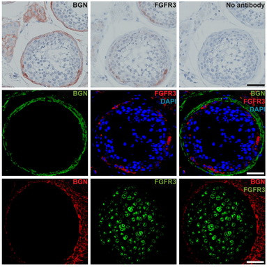 FGFR3 Antibody in Immunohistochemistry (IHC)