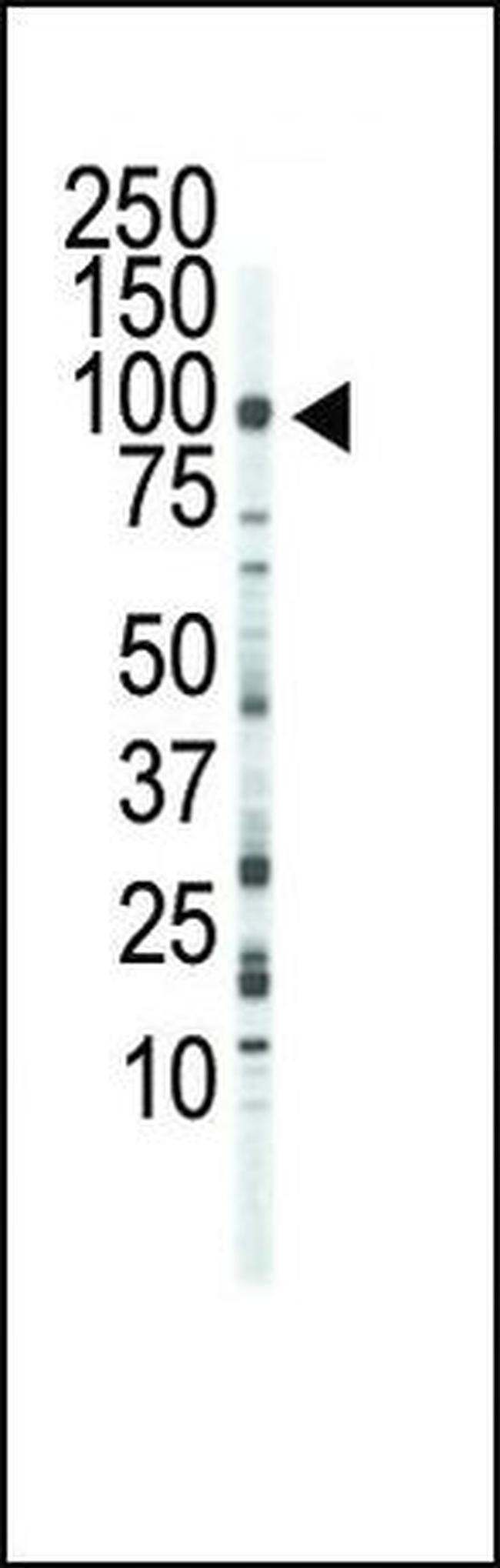 FGFR3 Antibody in Western Blot (WB)