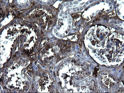 FGG Antibody in Immunohistochemistry (Paraffin) (IHC (P))