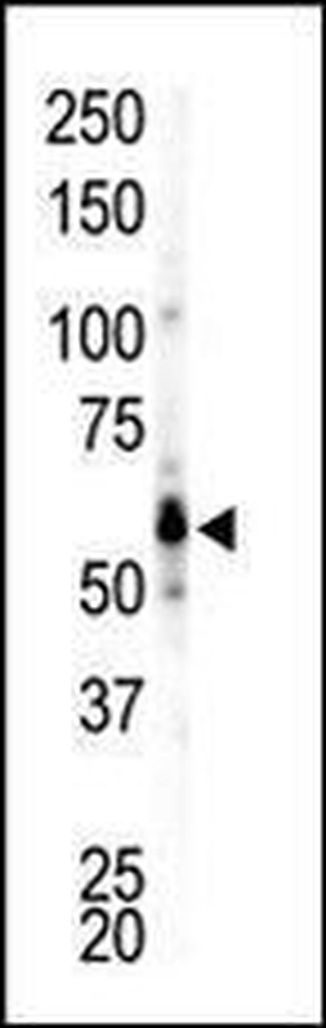 FGR Antibody in Western Blot (WB)