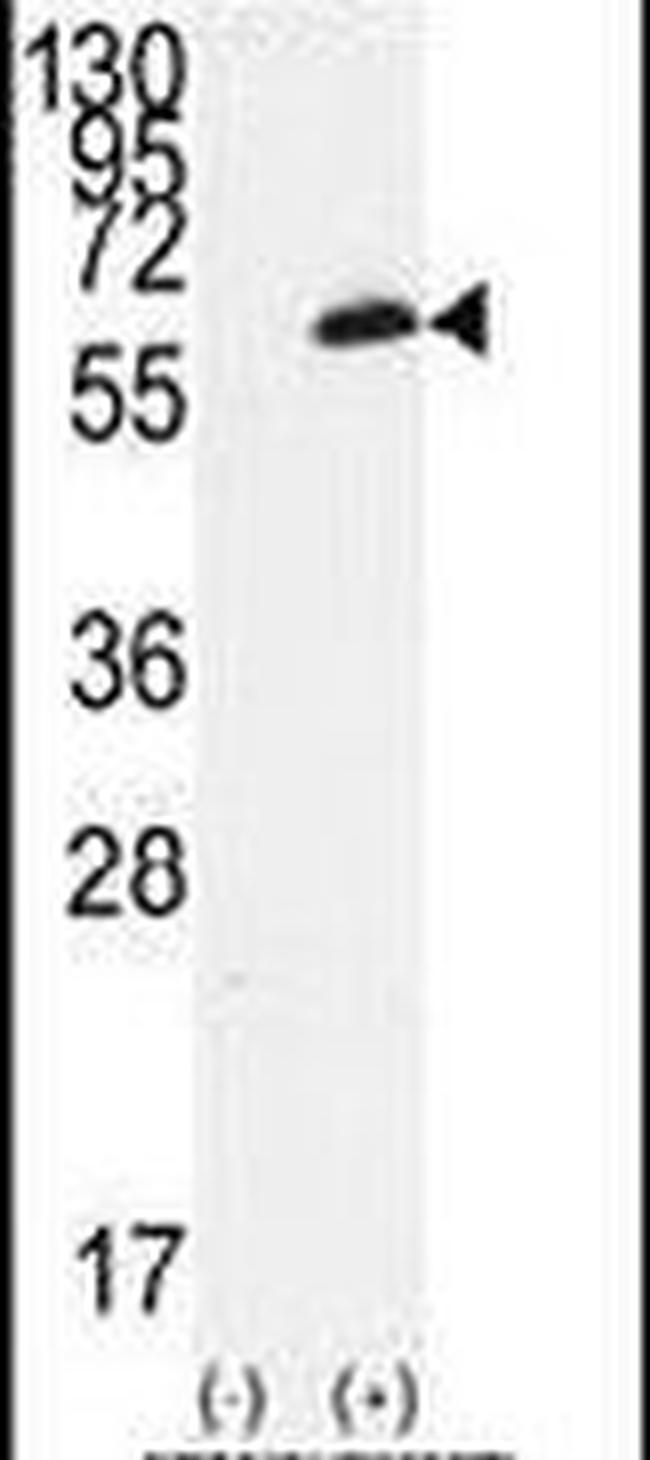 FGR Antibody in Western Blot (WB)