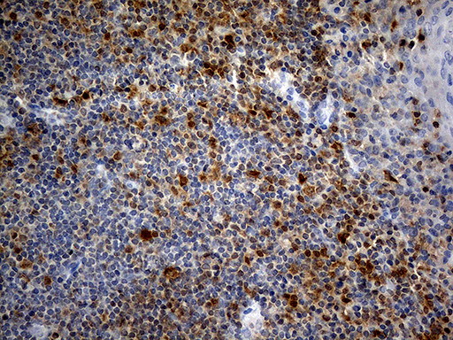 FHIT Antibody in Immunohistochemistry (Paraffin) (IHC (P))