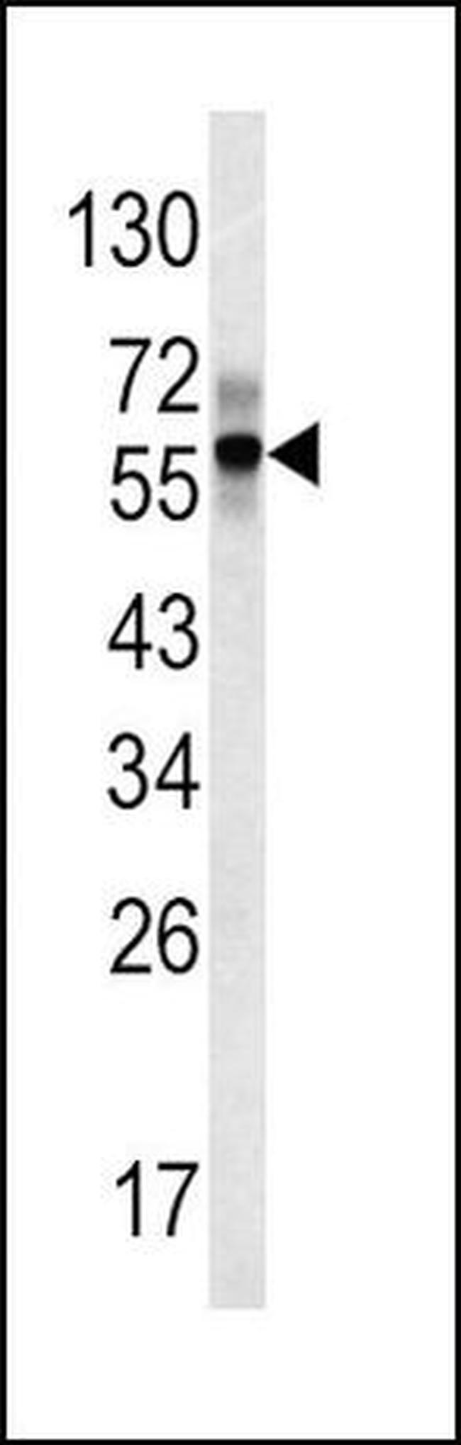 FIBB Antibody in Western Blot (WB)