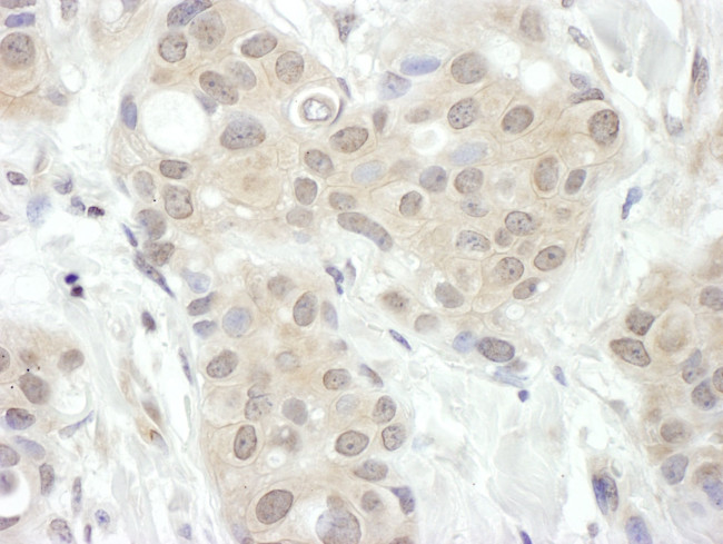 FIH-1 Antibody in Immunohistochemistry (IHC)