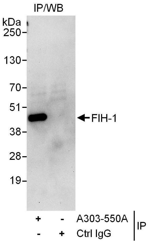 FIH-1 Antibody in Immunoprecipitation (IP)