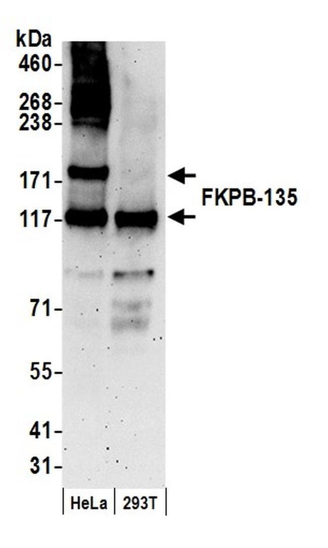 FKBP-135 Antibody in Western Blot (WB)