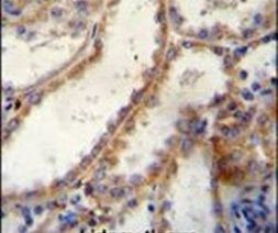 FKBP10 Antibody in Immunohistochemistry (IHC)