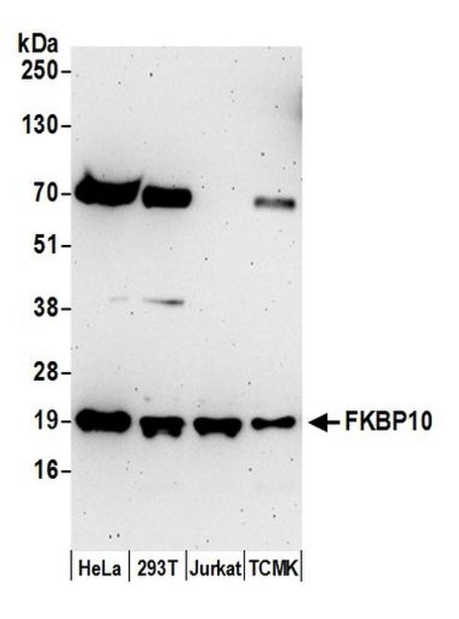 FKBP10 Antibody in Western Blot (WB)