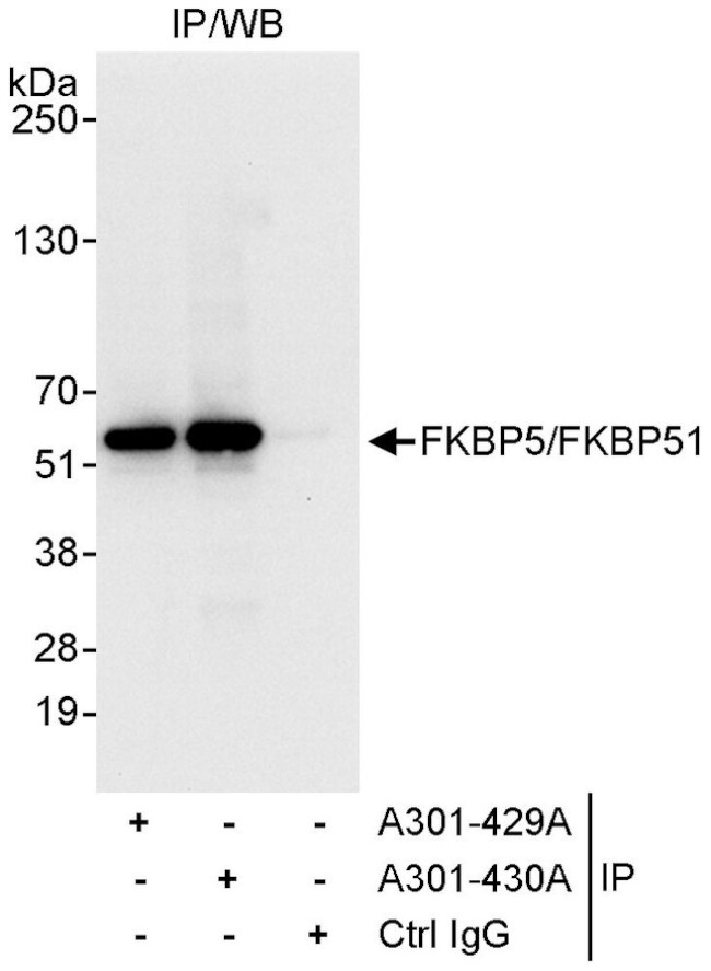 FKBP5/FKBP51 Antibody in Immunoprecipitation (IP)
